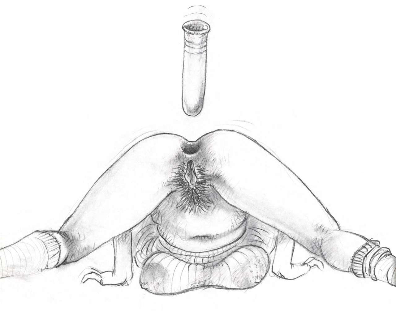 Anal Canal page 12 full