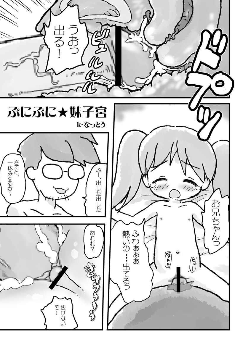 Shikyuu Sensen Ijou Nashi - All Quiet on the Womb Front - page 7 full